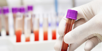 Society of Toxicology 62nd Annual Meeting