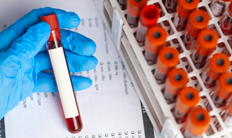 Clinical Study Image