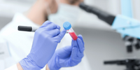 Contract Pharma