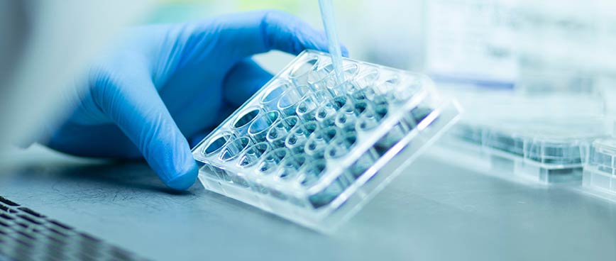ADME • Tox Screening