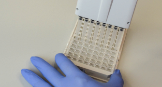 Development and validation of an LC-MS/MS method for the quantification of fascin proteins in human serum