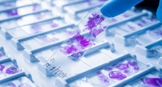 STP 2025: Organ Weight Data Interpretation in Toxicology Studies