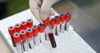 WRIB 2025: Innovative Strategy for Overcoming pH-Related Assay Variation in the Development and Validation of a Pharmacokinetic Assay for OBI-992, a TROP2-Targeting Exatecan-Based Antibody-Drug Conjugate, in Human Serum