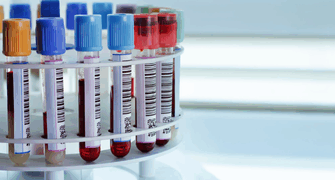 WRIB 2025: Validation of an Ultra-High Sensitive Simoa Assay for the Quantitation of IL-17A in Human Serum