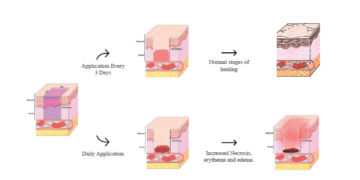 ACT 2025 Study Design Considerations for Wound Healing Research in Göttingen Minipigs