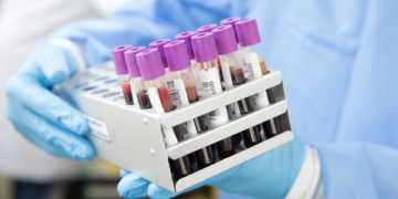 Utilization of High Sensitivity Proteomics NULISA HT Panels for Clinical Biomarker Profiling: Assay Qualification and Regulatory Consideration