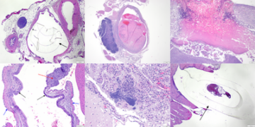 Procedural-related Microscopic Observations in Rats with Indwelling Intravenous Catheters in Nonclinical Toxicology Studies